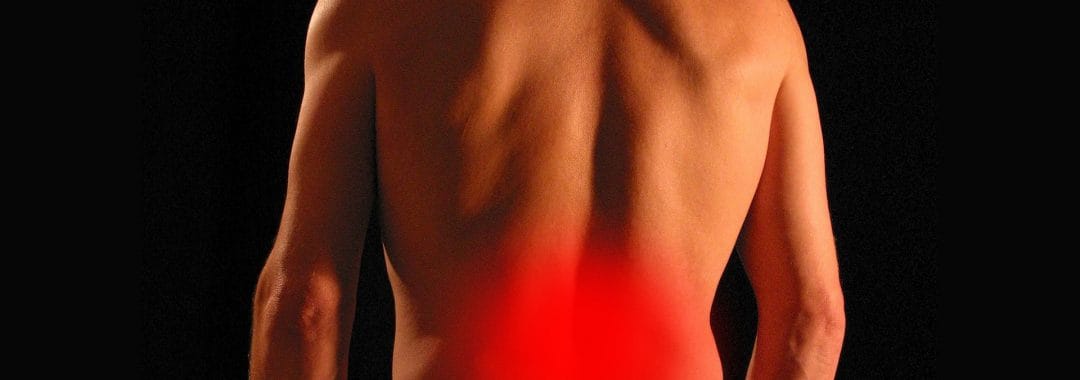 A pulled or strained lower back muscle with the recovery area highlighted in red