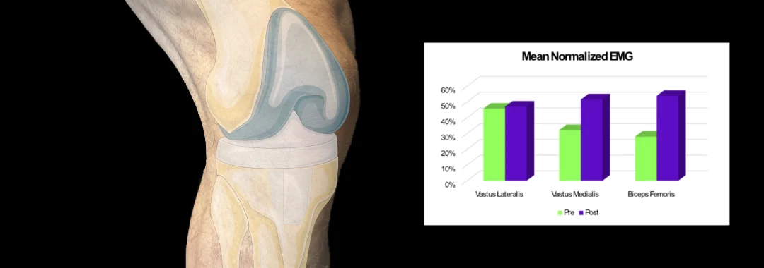A leg exercising with a knee replacement showing EMG values