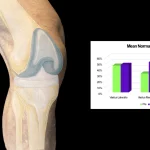 A leg exercising with a knee replacement showing EMG values